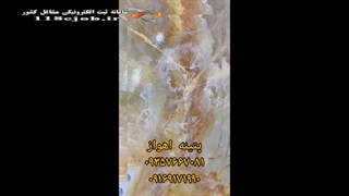 پتینه فرهادی در اهواز لیپوماتیک