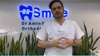 کشیدن دندان در ارتودنسی