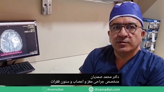 عمل جراحی تومور متاستاتیک مغزی