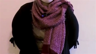 تجربه 10 روز پس از جراحی لاغری