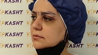 نتیجه بلافاصله بعد از کاشت ابرو هزینه کاشت ابرو 1401- کلینیک vip