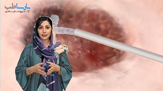 طبقه بندی زخم