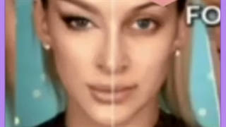 بهترین دکتر برای چشم روباهی در تهران