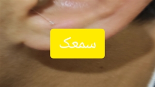 سمعک نامریی زیمنس
