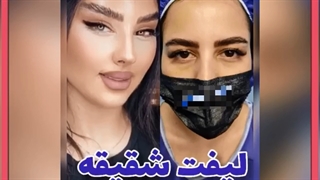 چشم گربه ای با فیلر چطور است؟