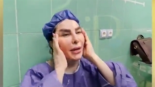 نتیجه لیفت کامل صورت (لیفت شقیقه، لیفت ابرو و..) -کلینیک vip تهران