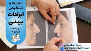 معاینه و تشخیص ایرادات بینی در جلسه مشاوره قبل عمل