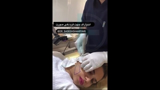 لیفتینگ و جوانسازی پوست با دستگاه پزشکی Aphrodite ابرسانی پوست
