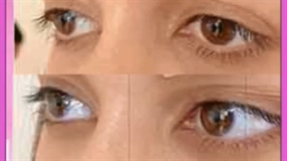 عکس چشم روباهی طبیعی