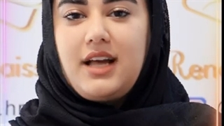 کاشت ابرو