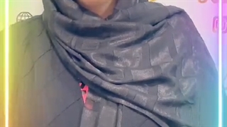 کاشت ابرو