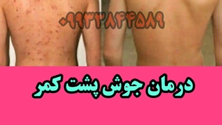 درمان و بهبودی جوش صورت رادیوگرافی دندان