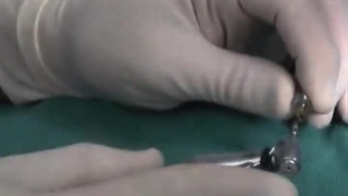 مشخصه های ایمپلنت فوری لیزری