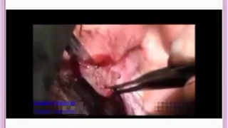 چه زمانی و چرا به یک متخصص جراحی مراجعه کنیم؟