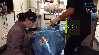 جراحی دندان نیش نهفته در کلینیک دکتر آقاجری