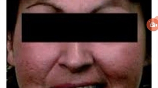 اشتباه در تزریق در خط غم. دکتر ابراهیم مقیمی