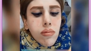 درمان لاغری صورت در یک هفته