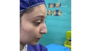 عمل بینی مدل طبیعی
