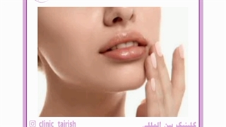 زیبایی لب ها با جراحی