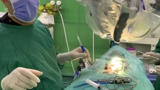 جراحی تنگی کانال نخاعی بیمار با میلوپاتی