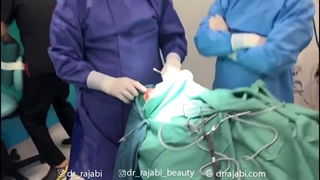 جراحی کیست های شکلاتی ناشی از خونریزی در لنفانژیوم کاسه چشم