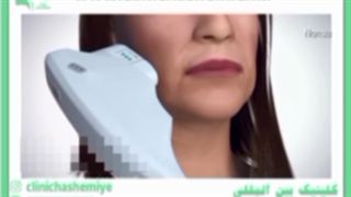 لیفت صورت بدون جراحی چگونه است؟