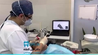 اسکن دیجیتال دندان‌ها برای الاینر