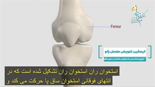 انیمیشن تعویض مفصل زانو
