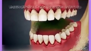 متخصص بیماری لثه (پریودنتیست) کیست؟