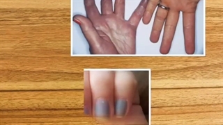 علائم کمبود اکسیژن