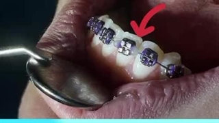 نکات ارتودنسی