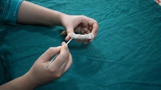 فیلم تشریح جناغ انسان-مهدی محمد حسین زاده