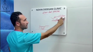 توضیحات کامل در مورد پوزیشن شوک | جمشیدیان هلث