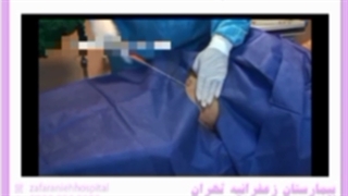 آیا بعد از تزریق چربی به صورت می توانیم ورزش و یا حمام کنیم؟