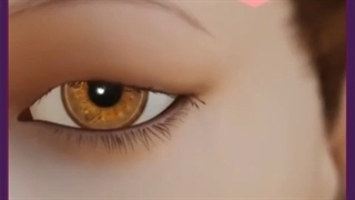 مزایای برداشتن پف چشم با لیزر