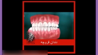 دندان قروچه چیست؟