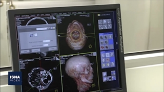 بازسازی چهره؛ سفری به ۱۳ هزار سال قبل