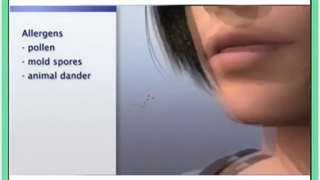 عفونت های ویروسی دهان