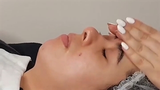 مراحل فیشیال صورت- کلینیک زیبایی آنا برداشتن توده
