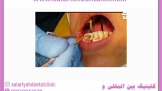 جراحی و تغییر شکل لثه جراحی بینی