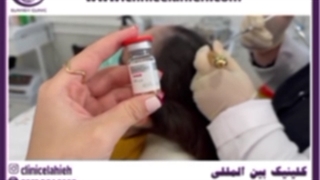 مزوتراپی مو توسط دکتر علیزاده