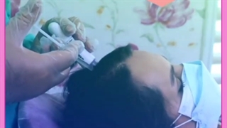 بهترین داروی مزوتراپی مو