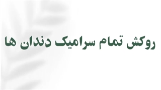 روکش تمام سرامیک دندان ها