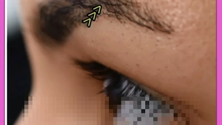 علت افتادگی ابروها چیست؟