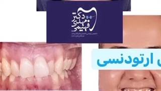 ارتودنسی دکتر مهدی فهیمی هنزائی