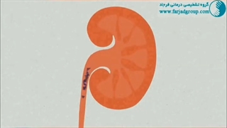 وقتی کلیه سنگ ساز می شود