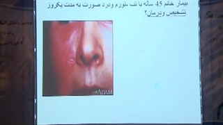 اریزیپل و ایمپتایگو و گزش کنه