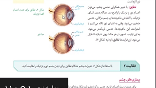 موسسه مشاوره کنکورآرت اراک-تدریس زیست یازدهم-جلسه 19-فصل 2 (بیماری های چشم)-امین فراهانی