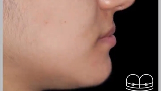 ارتودنسی و جراحی فک
