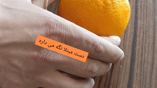 کاردرمانی سکته مغزی مشهد|توانبخشان عیسی حاتمی